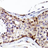Immunohistochemistry - Anti-Sall4 Antibody (A91160) - Antibodies.com