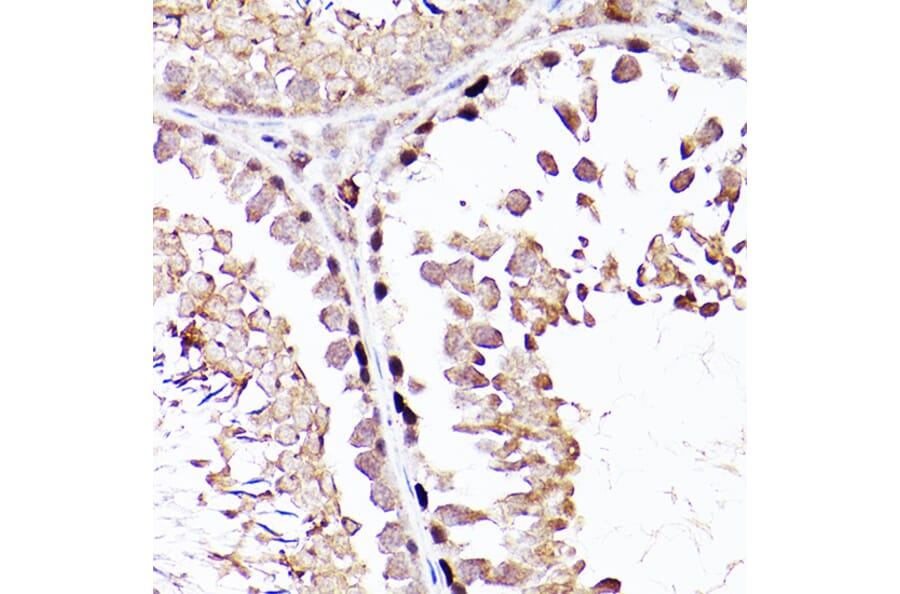 Immunohistochemistry - Anti-Sall4 Antibody (A91160) - Antibodies.com