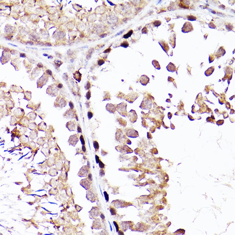 Immunohistochemistry - Anti-Sall4 Antibody (A91160) - Antibodies.com