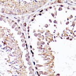 Immunohistochemistry - Anti-Sall4 Antibody (A91160) - Antibodies.com