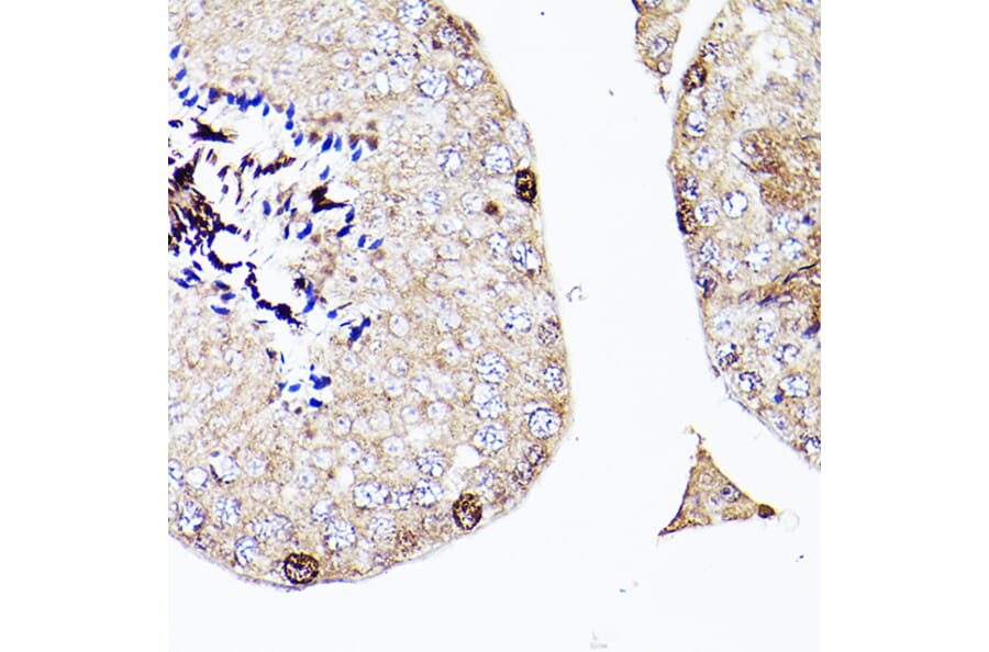 Immunohistochemistry - Anti-Sall4 Antibody (A91160) - Antibodies.com