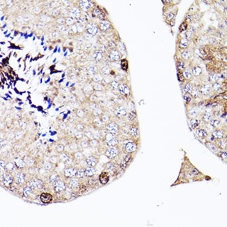 Immunohistochemistry - Anti-Sall4 Antibody (A91160) - Antibodies.com