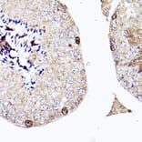 Immunohistochemistry - Anti-Sall4 Antibody (A91160) - Antibodies.com