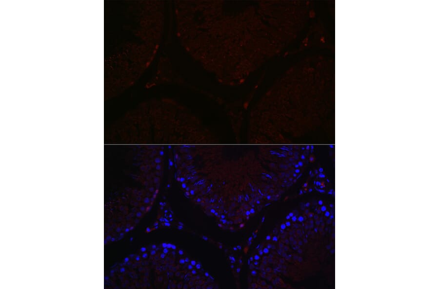 Immunofluorescence - Anti-Sall4 Antibody (A91160) - Antibodies.com