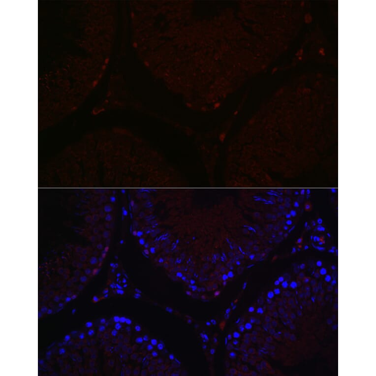 Immunofluorescence - Anti-Sall4 Antibody (A91160) - Antibodies.com
