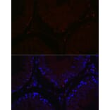 Immunofluorescence - Anti-Sall4 Antibody (A91160) - Antibodies.com