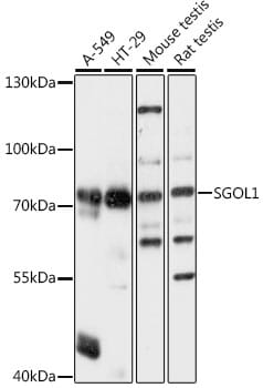 Western blot analysis of extracts of various cell lines, using Anti-SGOL1 Antibody (A16174) at 1:1,000 dilution.
Secondary antibody: Goat Anti-Rabbit IgG (H+L) (HRP) (AS014) at 1:10,000 dilution.
Lysates / proteins: 25µg per lane.
Blocking buffer: 3% non-fat dry milk in TBST.
Detection: ECL Basic Kit (RM00020).
Exposure time: 3s.