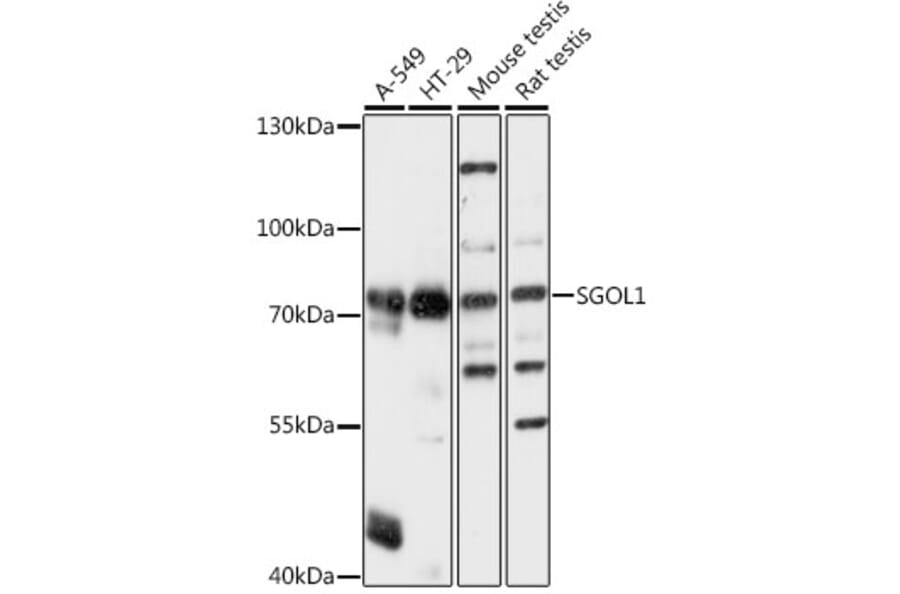 Western Blot - Anti-Shugoshin Antibody (A91161) - Antibodies.com