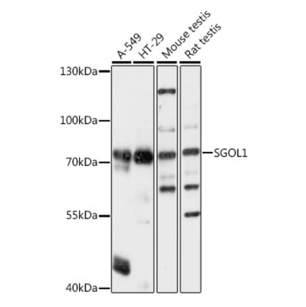 Western Blot - Anti-Shugoshin Antibody (A91161) - Antibodies.com