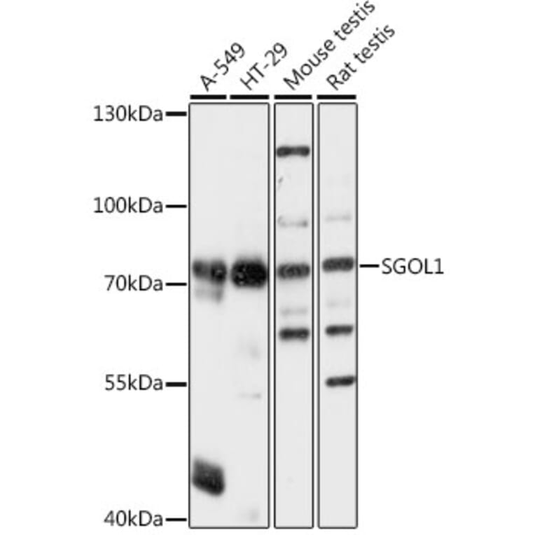 Western Blot - Anti-Shugoshin Antibody (A91161) - Antibodies.com