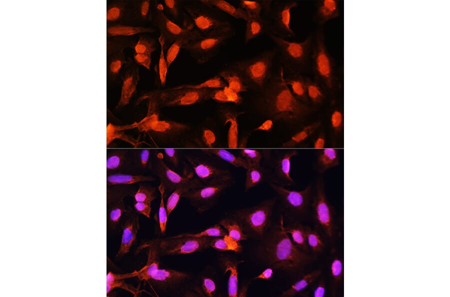 Immunofluorescence - Anti-Shugoshin Antibody (A91161) - Antibodies.com