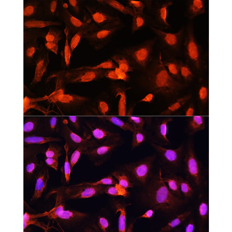 Immunofluorescence - Anti-Shugoshin Antibody (A91161) - Antibodies.com