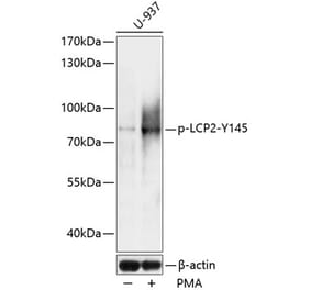Western Blot - Anti-SLP76 (phospho Tyr145) Antibody (A91162) - Antibodies.com