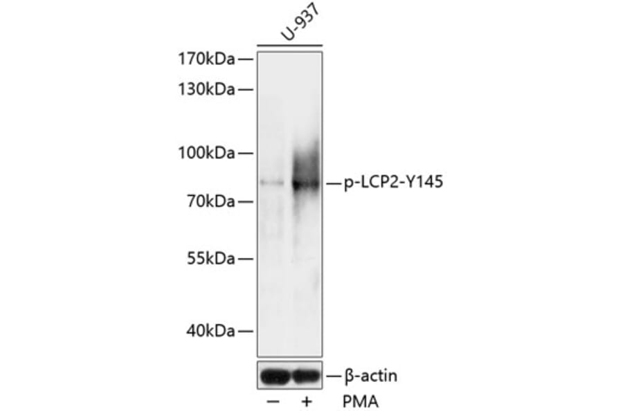 Western Blot - Anti-SLP76 (phospho Tyr145) Antibody (A91162) - Antibodies.com