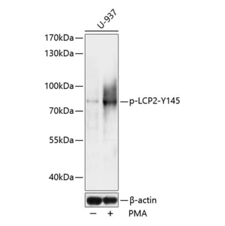 Western Blot - Anti-SLP76 (phospho Tyr145) Antibody (A91162) - Antibodies.com