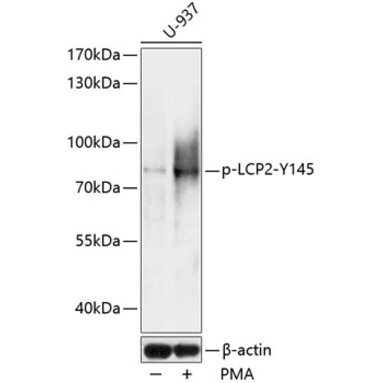 Western Blot - Anti-SLP76 (phospho Tyr145) Antibody (A91162) - Antibodies.com