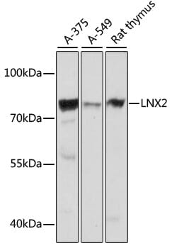 Western blot analysis of extracts of various cell lines, using Anti-LNX2 Antibody (A16611) at 1:1,000 dilution.
Secondary antibody: Goat Anti-Rabbit IgG (H+L) (HRP) (AS014) at 1:10,000 dilution.
Lysates / proteins: 25µg per lane.
Blocking buffer: 3% non-fat dry milk in TBST.
Detection: ECL Basic Kit (RM00020).
Exposure time: 1s.