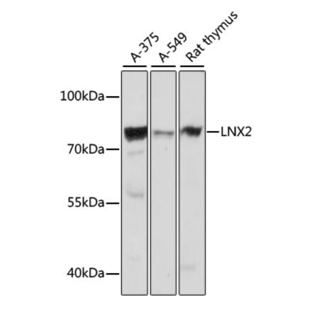 Western Blot - Anti-LNX2 Antibody (A91164) - Antibodies.com