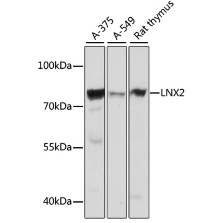 Western Blot - Anti-LNX2 Antibody (A91164) - Antibodies.com