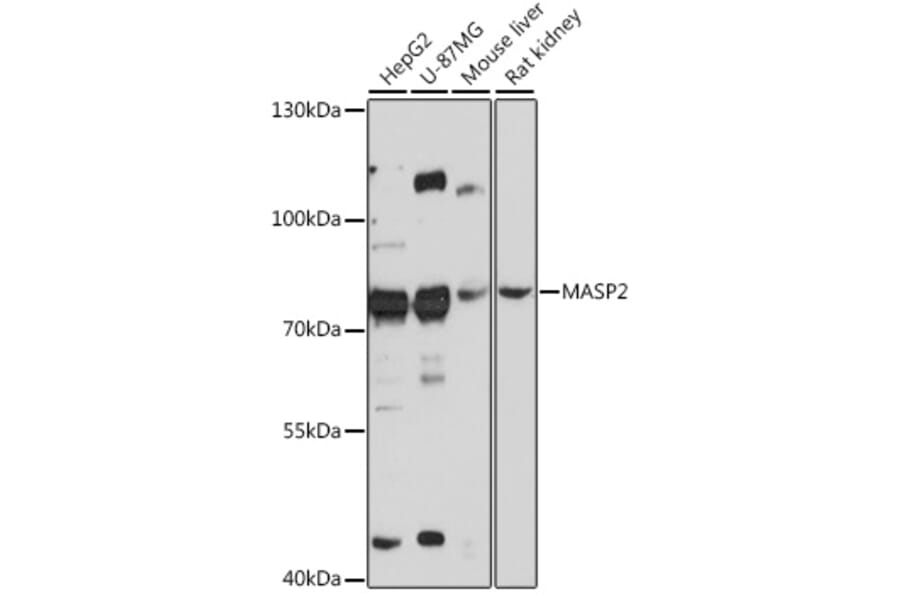Western Blot - Anti-MASP2 Antibody (A91165) - Antibodies.com