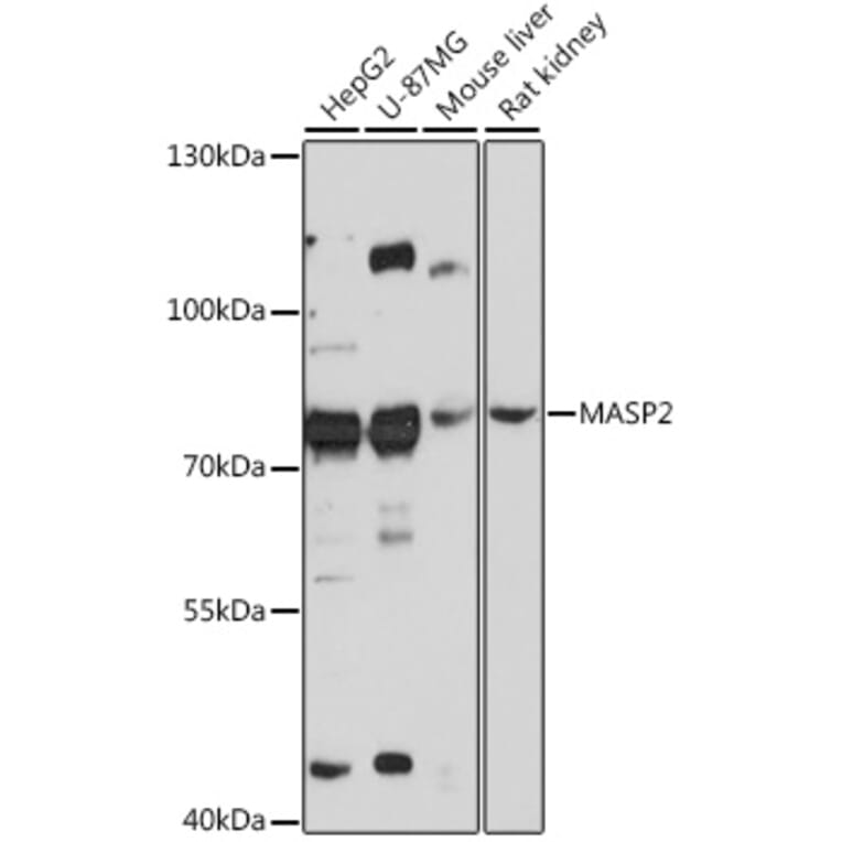 Western Blot - Anti-MASP2 Antibody (A91165) - Antibodies.com