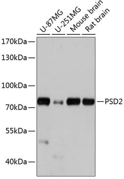 Western blot analysis of extracts of various cell lines, using Anti-PSD2 Antibody (A14429) at 1:1,000 dilution.
Secondary antibody: Goat Anti-Rabbit IgG (H+L) (HRP) (AS014) at 1:10,000 dilution.
Lysates / proteins: 25µg per lane.
Blocking buffer: 3% non-fat dry milk in TBST.
Detection: ECL Basic Kit (RM00020).
Exposure time: 5s.