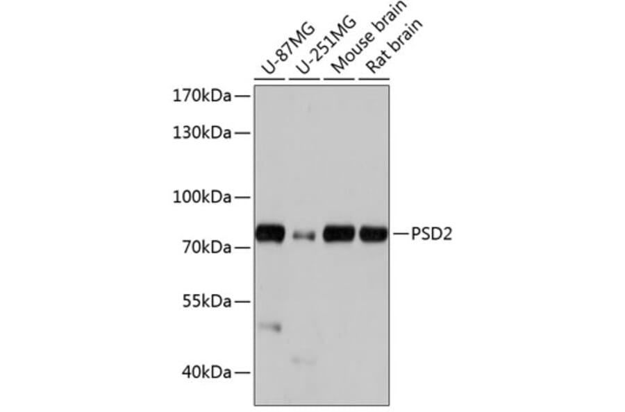 Western Blot - Anti-PSD2 Antibody (A91166) - Antibodies.com