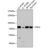 Western Blot - Anti-PSD2 Antibody (A91166) - Antibodies.com