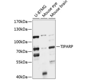 Western Blot - Anti-PARP7 Antibody (A91167) - Antibodies.com