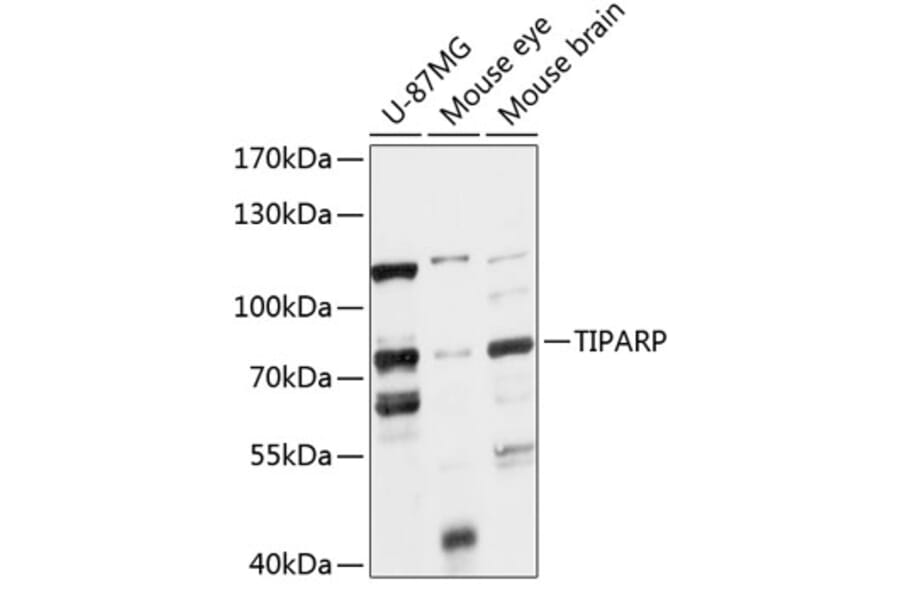 Western Blot - Anti-PARP7 Antibody (A91167) - Antibodies.com