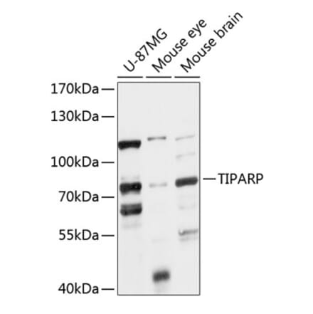 Western Blot - Anti-PARP7 Antibody (A91167) - Antibodies.com