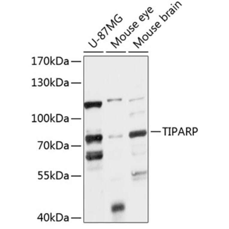 Western Blot - Anti-PARP7 Antibody (A91167) - Antibodies.com