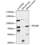 Western Blot - Anti-PARP7 Antibody (A91167) - Antibodies.com