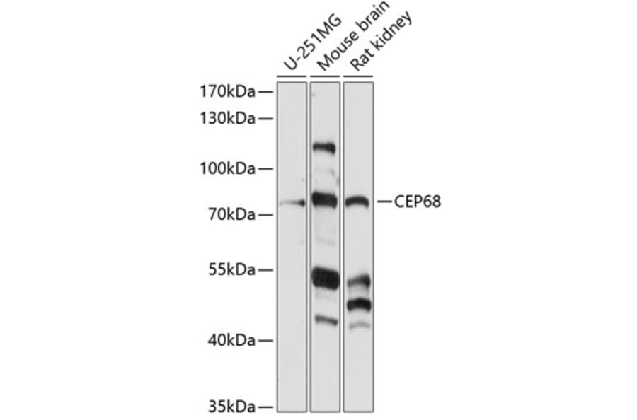 Western Blot - Anti-CEP68 Antibody (A91168) - Antibodies.com