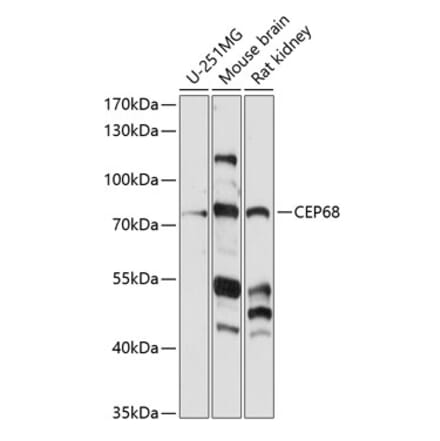 Western Blot - Anti-CEP68 Antibody (A91168) - Antibodies.com