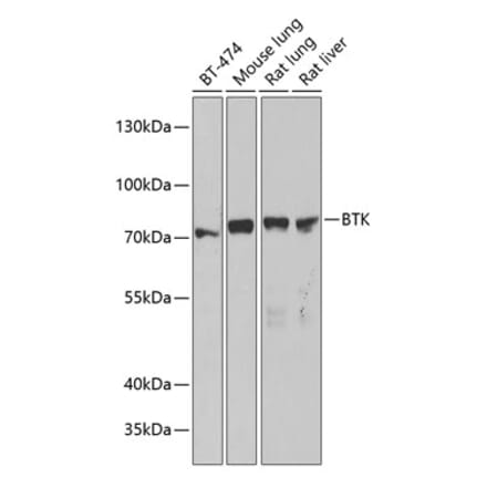 Western Blot - Anti-BTK Antibody (A91169) - Antibodies.com