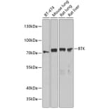 Western Blot - Anti-BTK Antibody (A91169) - Antibodies.com