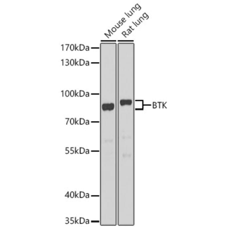 Western Blot - Anti-BTK Antibody (A91169) - Antibodies.com