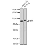 Western Blot - Anti-BTK Antibody (A91169) - Antibodies.com
