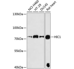 Western Blot - Anti-HIC1 Antibody (A91170) - Antibodies.com