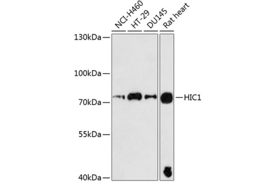 Western Blot - Anti-HIC1 Antibody (A91170) - Antibodies.com