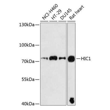 Western Blot - Anti-HIC1 Antibody (A91170) - Antibodies.com