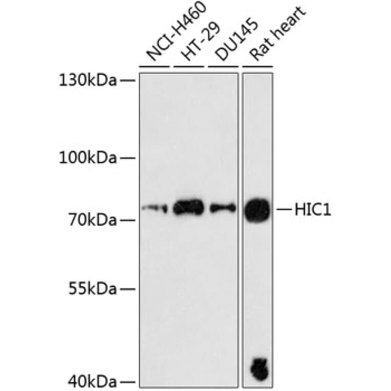 Western Blot - Anti-HIC1 Antibody (A91170) - Antibodies.com