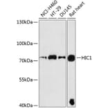 Western Blot - Anti-HIC1 Antibody (A91170) - Antibodies.com