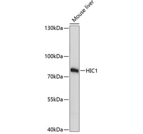 Western Blot - Anti-HIC1 Antibody (A91171) - Antibodies.com