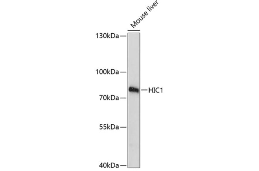 Western Blot - Anti-HIC1 Antibody (A91171) - Antibodies.com