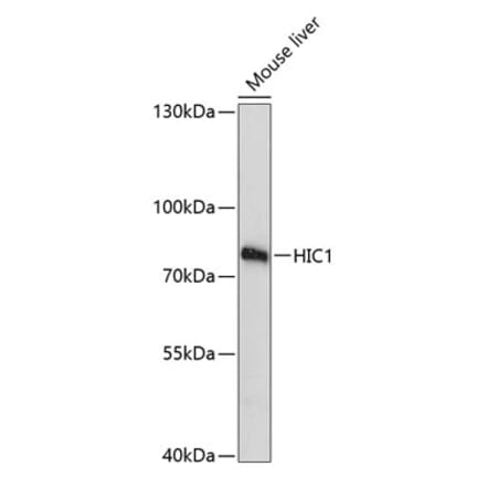Western Blot - Anti-HIC1 Antibody (A91171) - Antibodies.com