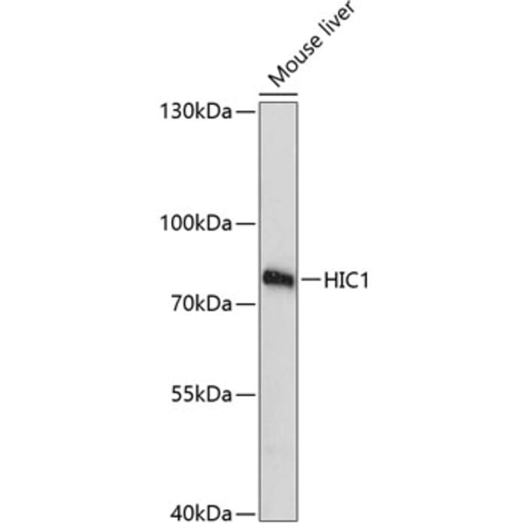 Western Blot - Anti-HIC1 Antibody (A91171) - Antibodies.com