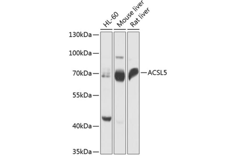 Western Blot - Anti-ACSL5 Antibody (A91172) - Antibodies.com