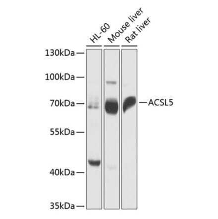 Western Blot - Anti-ACSL5 Antibody (A91172) - Antibodies.com